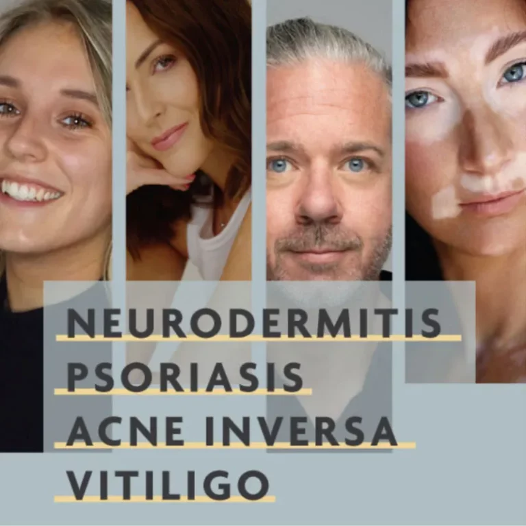 Flyer für die Hautwochen 2025 mit Schwerpunkt Vitiligo