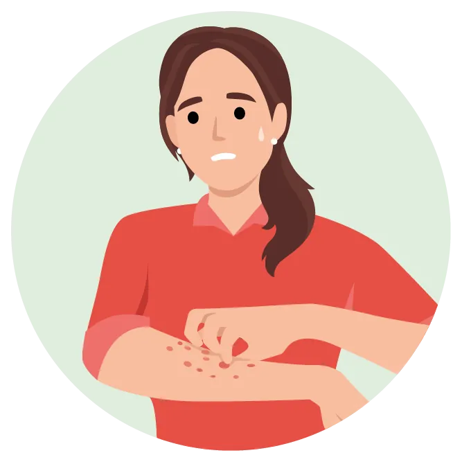 Illustration einer Frau, die sich wegen Schuppenflechte am Arm kratzt (Psoriasis), als mögliche Autoimmun-Erkrankung im Zusammenhang mit einer nichtsegmentalen Vitiligo.