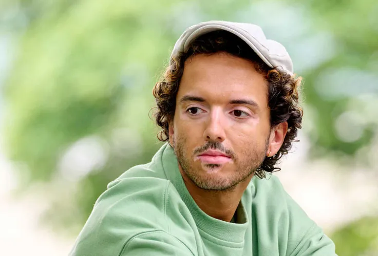 Mann mit Vitiligo Weissfleckenkrankheit im Gesicht und auf den Händen, heller Hauttyp mit dunklen Haaren.