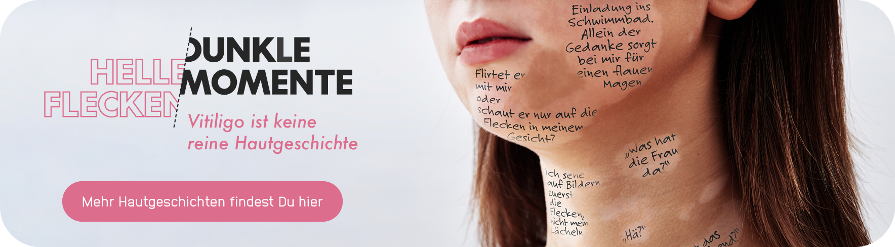 Ausschnitt des Gesichts einer Frau mit Vitiligo, in ihren hellen Flecken stehen Zitate und Gedanken, die dunkle Momente darstellen