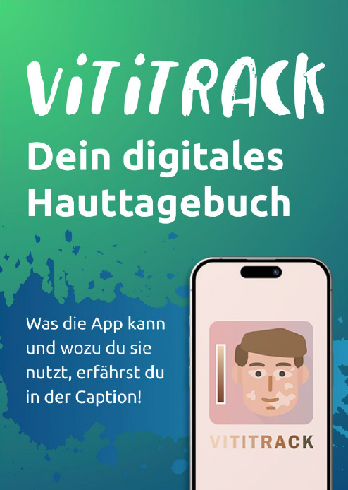 Post von @uncovervitiligo, dem Instagram-Kanal für Menschen mit Vitiligo, über die App Vititrack, das digitale Hauttagebuch